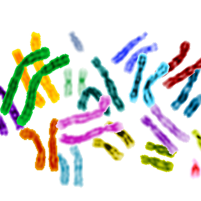 Homologous chromosomes? Exploring human sex chromosomes, sex determination and sex reversal using bioinformatics approaches