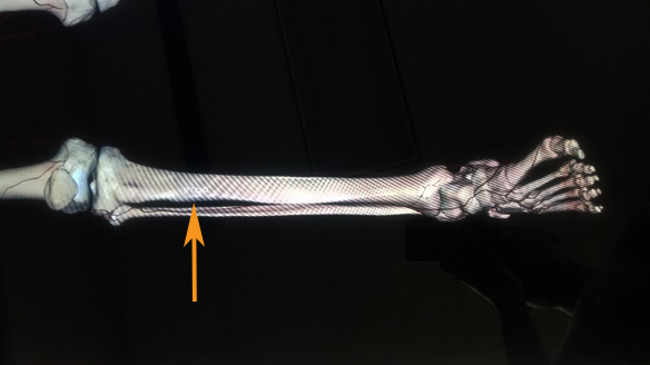 Figure 4. Photograph of the right tibia having been selected to display its labeled name. 