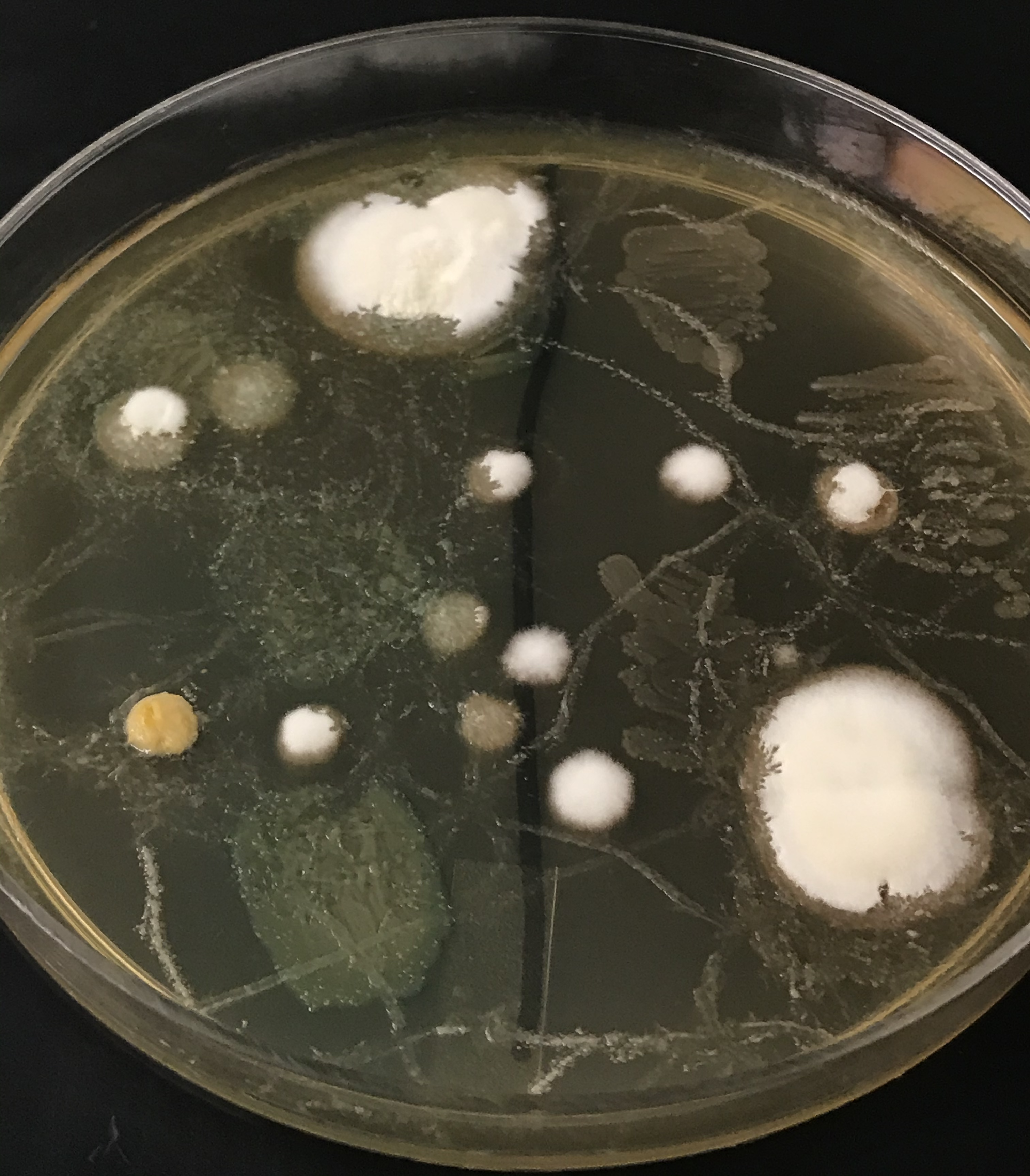 Small Organisms with Big Consequences: Understanding the Microbial World Around Us